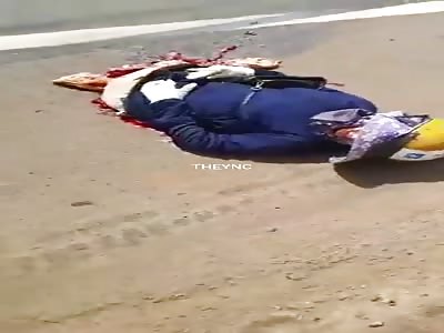 Tragic accident leaves a girl split in half