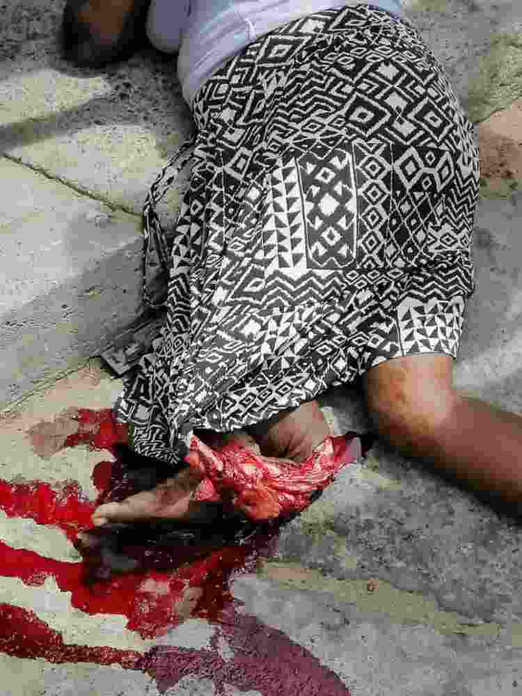 Ouch ma'am it must have hurt