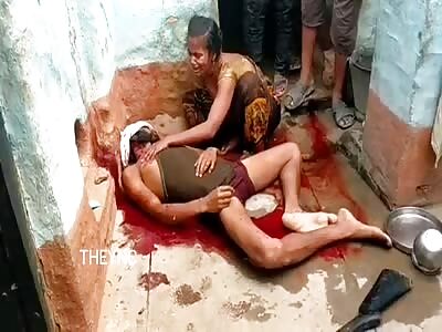 Drunk shot himself in the head