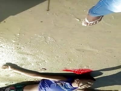 Man shot in the head