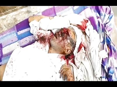 Man stabbed to death in the face