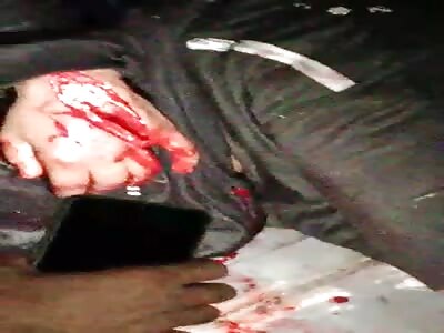 Young man was attacked with a machete