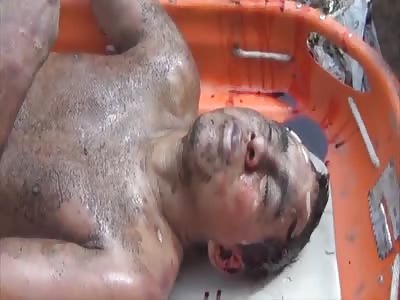 Fisherman pulls out a corpse instead of fish in a pond