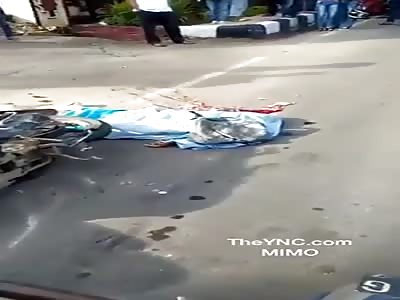 Woman suffers terrible accident and her brain comes out of her skull