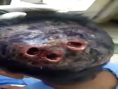 a bowling ball? no, it's a boring head full of WTF worms