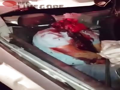  Dude fucked up in an accident