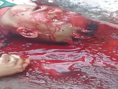 trafficker got shot in the eye in Manaus