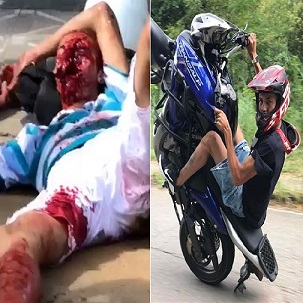 Man's Face Ripped Out In Horrible Accident