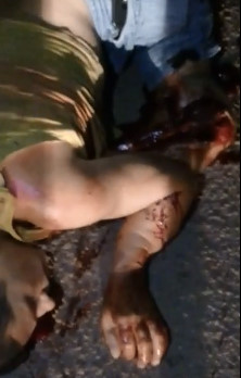 There's No Putting that Leg Back Together