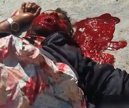 His Last Expression is Horrific