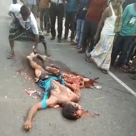 Boy Run over by Something Heavy is Nothing but Guts Now