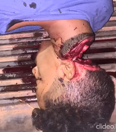 Bloody Homicide Scene