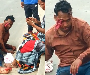 I'm Sure He Will Be Needing a Glass Eye