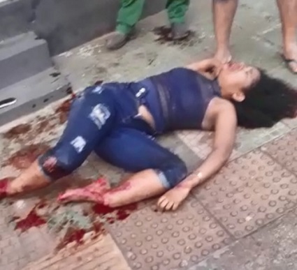 Leg Thoroughly Broken, Girl Squirming In Pain