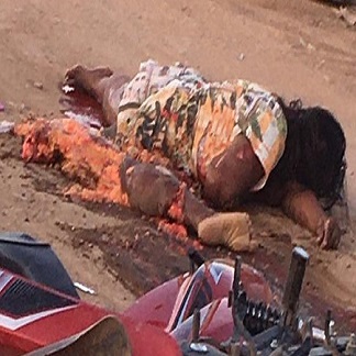 Gruesome: Woman Dismembered By The Truck In Brazil