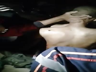 Injured stabbed a few times