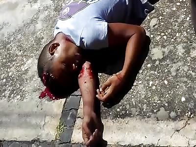 Shot in the head dying