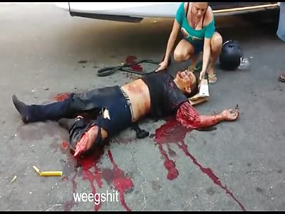 Guy badly injured after accident 