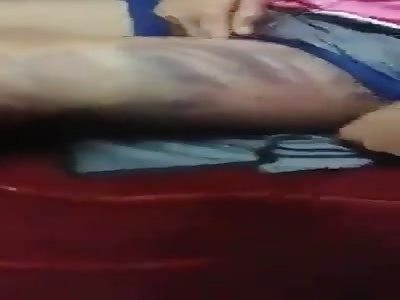 Woman with bruises after abuse 