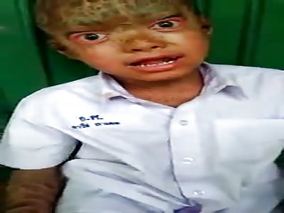Kid with weird skin condition 