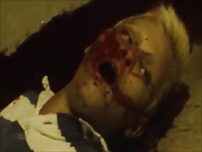 Guy shot in the head breathing his last 