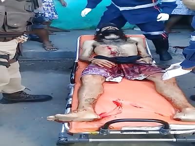 Injured guy taken to hospital 