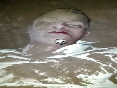 Injured fucker dying 