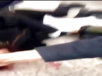 A Young girl lost her eye from a flashball shot fired by the police