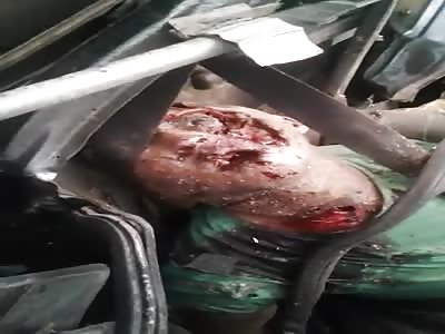 Car Accident ALL FUCKED UP! 