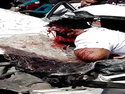 man with head explode in accident
