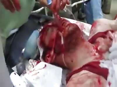 Saving Life Of Brutally Injured Man