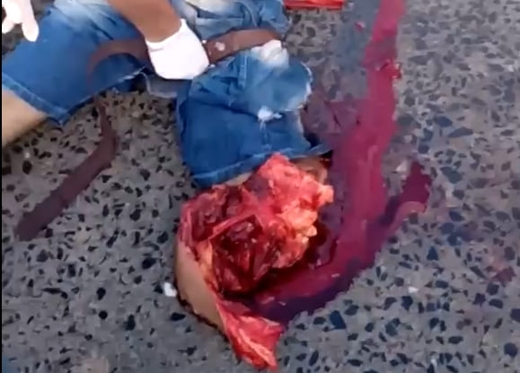 Dudes Leg is FUBAR'd