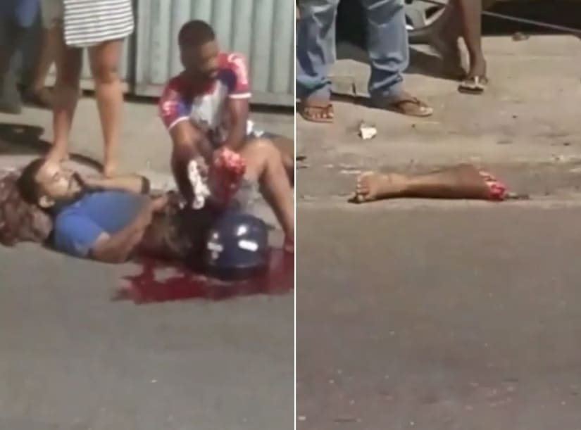 Casually Lying in the Road with His Leg Missing 