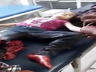 little girl with terrible leg injury