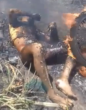 Burnt Man With His Nuts Smoldering 