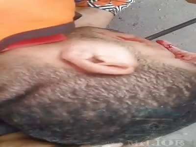 shocking accident man has a key stuck in his mouth