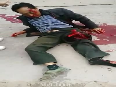 Man with leg destroyed