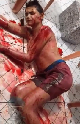 Aftermath of Savage Machete Assault