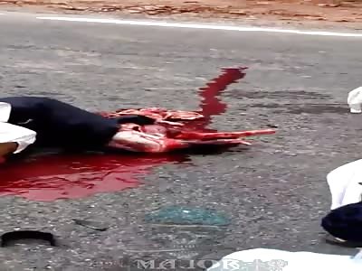 Shocking, legs smashed by truck