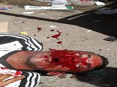 DAMN: Angry Mob Has Their Way with This Dude