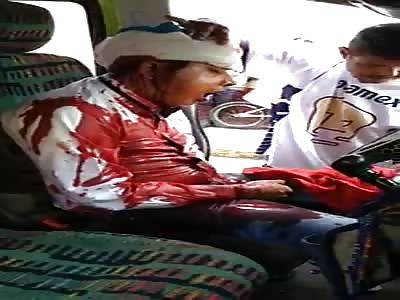 Victim of shots in agony