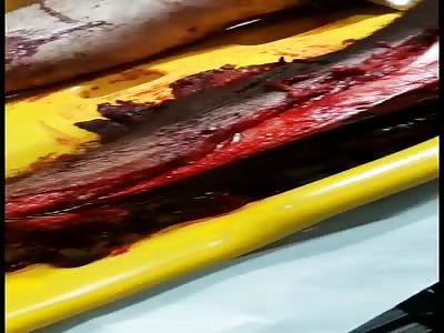 Victim of terrible accident 