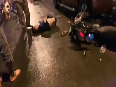 Victim of terrible accident 