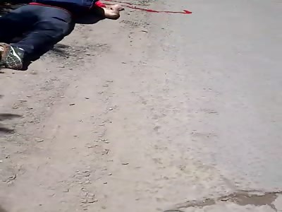 horrific death , man agony to death after get shot in head