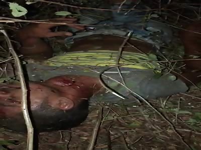 man victim of  accident in street