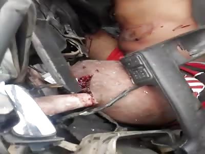 Shocking accident in street