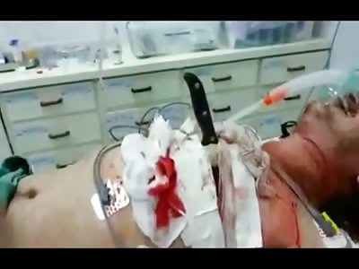 Trying to Save the Mans Life that Has Kitchen Knife Stuck in his Chest 