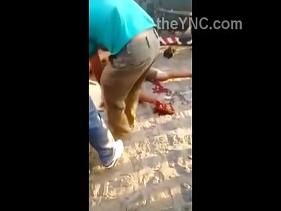 Mans Foot is FUBAR'd