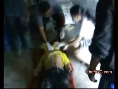 Teenage Suicide in Crummy Apartment has the Muscles Massaged to remove Rigormortis