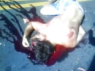 Ouch I have a Terrible Headache